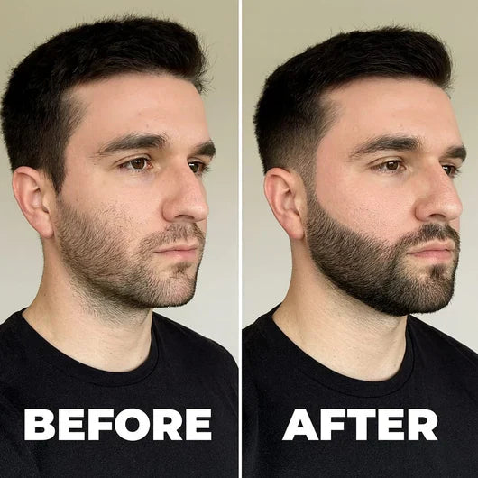 Noyl's Elite Beard Revival Grooming Kit for Men's Daily Care