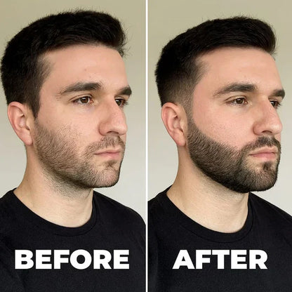 Noyl's Elite Beard Revival Grooming Kit for Men's Daily Care